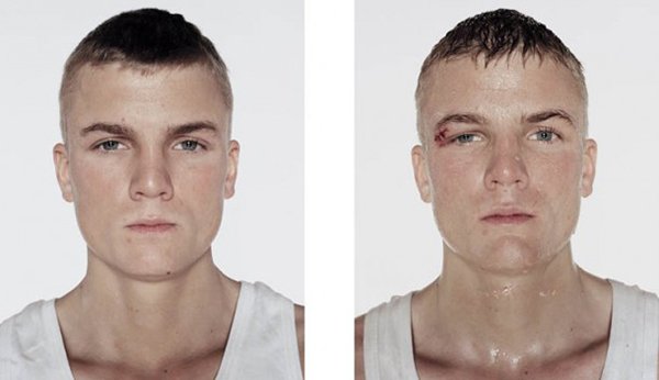 Antes e depois da briga (11)