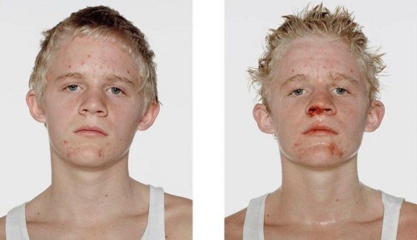 Antes e depois da briga (12)