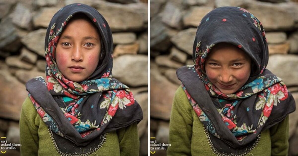 Pessoas antes e depois de um sorriso 3